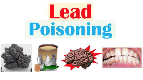 How much lead is toxic?